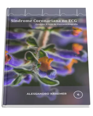 Livro 4 - Síndrome Coronariana no ECG