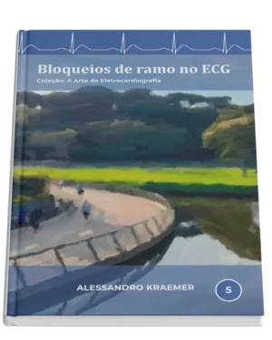 Livro 5 - Bloqueios de Ramo no ECG