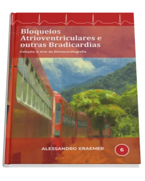 Livro 6 - Bloqueios Atrioventriculares e Outras Bradicardias