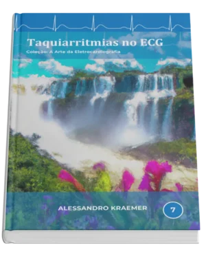 Livro 7 - Taquiarritmias no ECG