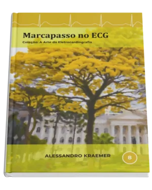 Livro 8 - Marcapasso no ECG